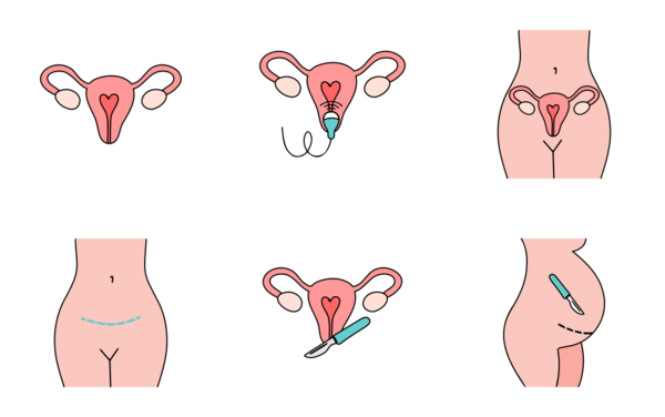 gynecology